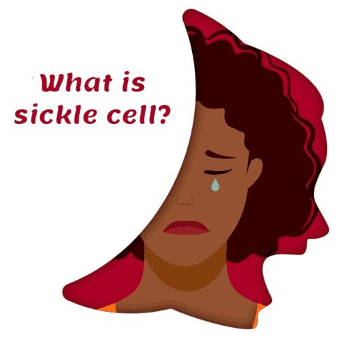 what is sickle cell removebg preview (1)